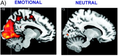 Brain images