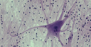 Neuronas su aksonais